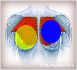 Расположение нижнего полюса молочной железы
